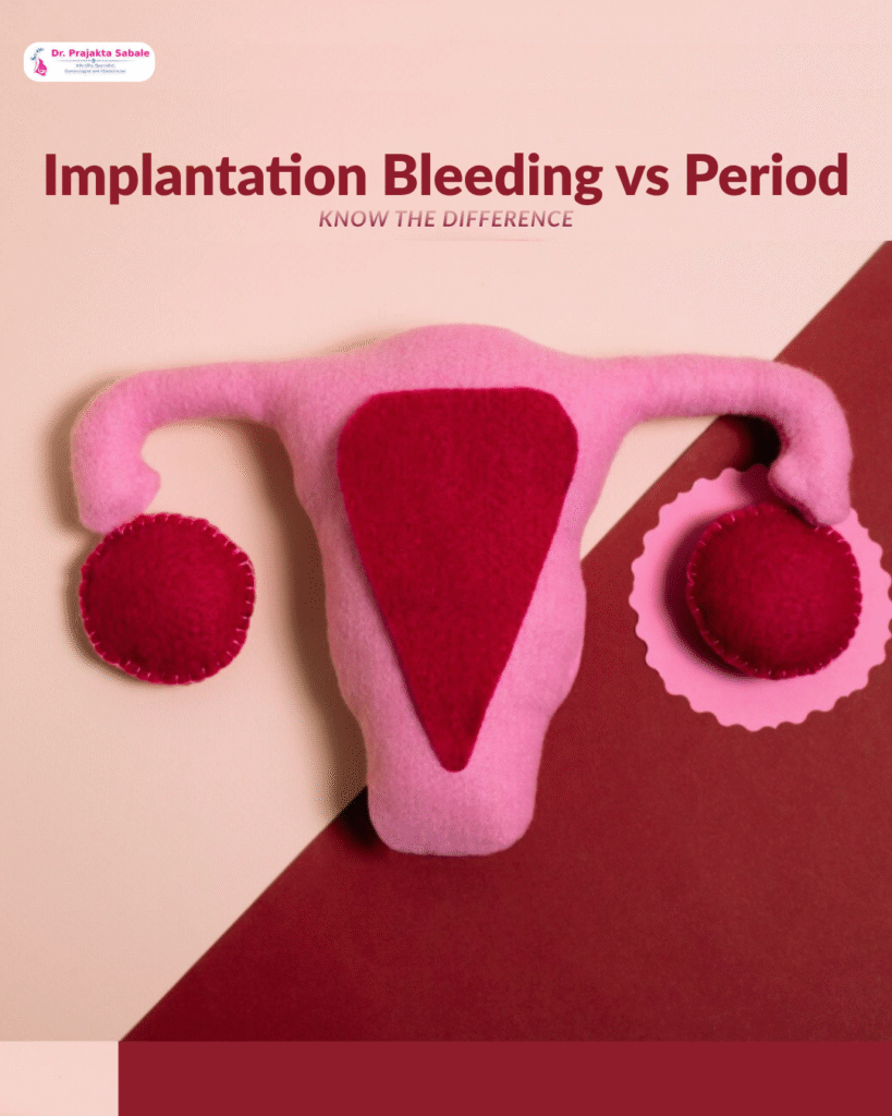 Implantation Bleeding vs Period